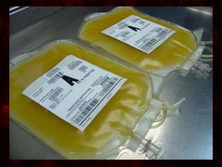 Platelets
• Composition:
- Platelets
- Plasma
- RBCs
- WBCs
• Purpose:
- Helps to stop bleeding (restore clotting ability)
- Essential for coagulation of blood
• Indications:
- Decreased platelet count
- Hemophilia
- Thrombocytopenia
- Platelet dysfunction (End stage renal disease, DIC)
 