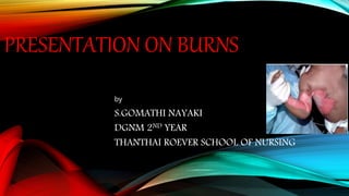 PRESENTATION ON BURNS
by
S.GOMATHI NAYAKI
DGNM 2ND YEAR
THANTHAI ROEVER SCHOOL OF NURSING
 