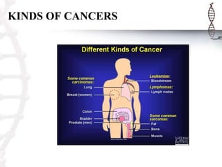 KINDS OF CANCERS
 