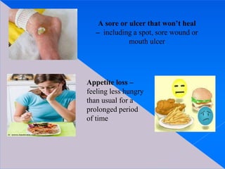 A sore or ulcer that won’t heal
– including a spot, sore wound or
mouth ulcer
Appetite loss –
feeling less hungry
than usual for a
prolonged period
of time
 