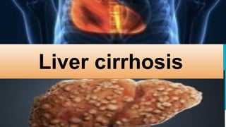 Liver cirrhosis
 