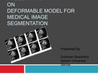 PRESENTATION
ON
DEFORMABLE MODEL FOR
MEDICAL IMAGE
SEGMENTATION
Presented By
Subhash Basishtha
Assam University
Silchar
 