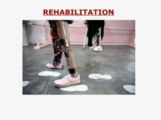 REHABILITATION 