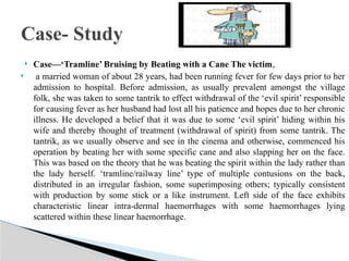  Presentation on examination of bruise.pptx Illustration 