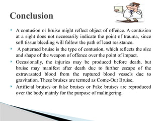  Foto zu Presentation on examination of bruise.pptx 