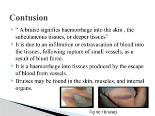 Presentation on examination of bruise.pptx