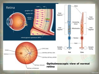 Opthalmoscopic view of normal
retina
 