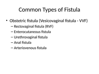 Presentation_on_Fistula_by_GROUP_TWO.pptx