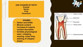 AGE CHANGES IN TEETH
Enamel
Dentin
Pulp
Cementum
ENAMEL
• Darker and brittle
• Mineral content
increases & organic
content decreases
• Exhibits physiological
wear ( chipping,
wearing, craze lines,
staining of chipped
areas)
 