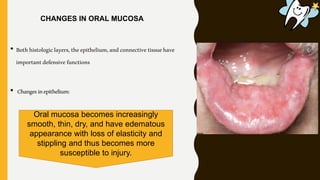 • Bothhistologiclayers,theepithelium,andconnectivetissuehave
importantdefensivefunctions
• Changesinepithelium:
Oral mucosa becomes increasingly
smooth, thin, dry, and have edematous
appearance with loss of elasticity and
stippling and thus becomes more
susceptible to injury.
CHANGES IN ORAL MUCOSA
 