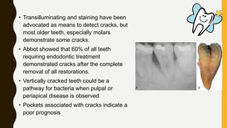 • Transilluminating and staining have been
advocated as means to detect cracks, but
most older teeth, especially molars
demonstrate some cracks.
• Abbot showed that 60% of all teeth
requiring endodontic treatment
demonstrated cracks after the complete
removal of all restorations.
• Vertically cracked teeth could be a
pathway for bacteria when pulpal or
periapical disease is observed
• Pockets associated with cracks indicate a
poor prognosis
 