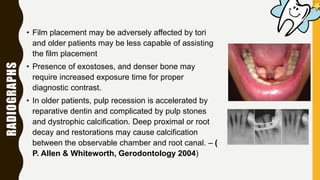 RADIOGRAPHS
• Film placement may be adversely affected by tori
and older patients may be less capable of assisting
the film placement
• Presence of exostoses, and denser bone may
require increased exposure time for proper
diagnostic contrast.
• In older patients, pulp recession is accelerated by
reparative dentin and complicated by pulp stones
and dystrophic calcification. Deep proximal or root
decay and restorations may cause calcification
between the observable chamber and root canal. – (
P. Allen & Whiteworth, Gerodontology 2004)
 