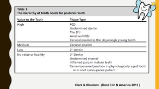 Clark & Khademi. (Dent Clin N America 2010 )
 