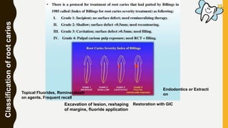 Topical Fluorides, Remineralizati
on agents, Frequent recall
Excavation of lesion, reshaping
of margins, fluoride application
Restoration with GIC
Endodontics or Extracti
on
Classificationofrootcaries
 