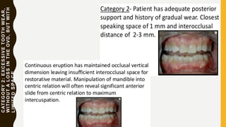CATEGORY2:EXCESSIVETOOTHWEAR,
WITHOUTALOSSINTHEOVD,BUTWITH
LIMITEDSPACE
 