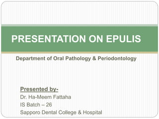 Presented by-
Dr. Ha-Meem Fattaha
IS Batch – 26
Sapporo Dental College & Hospital
PRESENTATION ON EPULIS
Department of Oral Pathology & Periodontology
 