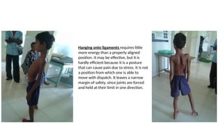 Hanging onto ligaments requires little
more energy than a properly aligned
position. It may be effective, but it is
hardly efficient because it is a posture
that can cause pain due to stress. It is not
a position from which one is able to
move with dispatch. It leaves a narrow
margin of safety, since joints are forced
and held at their limit in one direction.
 