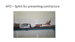 AFO – Splint for preventing contracture
 