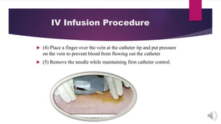  (4) Place a finger over the vein at the catheter tip and put pressure
on the vein to prevent blood from flowing out the catheter
 (5) Remove the needle while maintaining firm catheter control.
IV Infusion Procedure
 