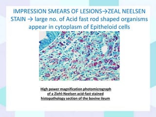 IMPRESSION SMEARS OF LESIONS→ZEAL NEELSEN
STAIN → large no. of Acid fast rod shaped organisms
appear in cytoplasm of Epitheloid cells
High power magnification photomicrograph
of a Ziehl-Neelsen acid-fast stained
histopathology section of the bovine ileum
 