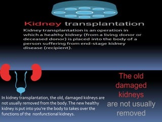 In kidney transplantation, the old, damaged kidneys are
not usually removed from the body.The new healthy
kidney is put into you’re the body to takes over the
functions of the nonfunctional kidneys.
 