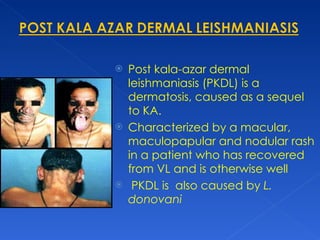 Presentation on leishmaniasis | PPT