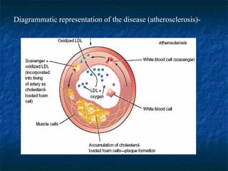 Diagrammatic representation of the disease (atherosclerosis)- 