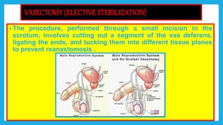 Presentation on male reproductive system by pooja | PPTX