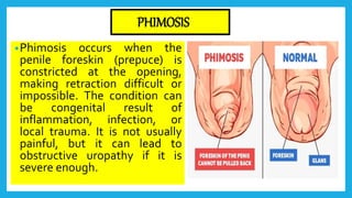 Presentation on male reproductive system by pooja | PPTX