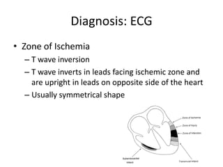 Diagnosis: ECG
• Zone of Ischemia
  – T wave inversion
  – T wave inverts in leads facing ischemic zone and
    are upright in leads on opposite side of the heart
  – Usually symmetrical shape
 