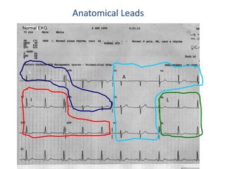 Anatomical Leads




L
               A



I                      L
 