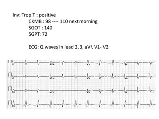 Inv: Trop T : positive
        CKMB : 98 ---- 110 next morning
        SGOT : 140
        SGPT: 72

       ECG: Q waves in lead 2, 3, aVf, V1- V2
 