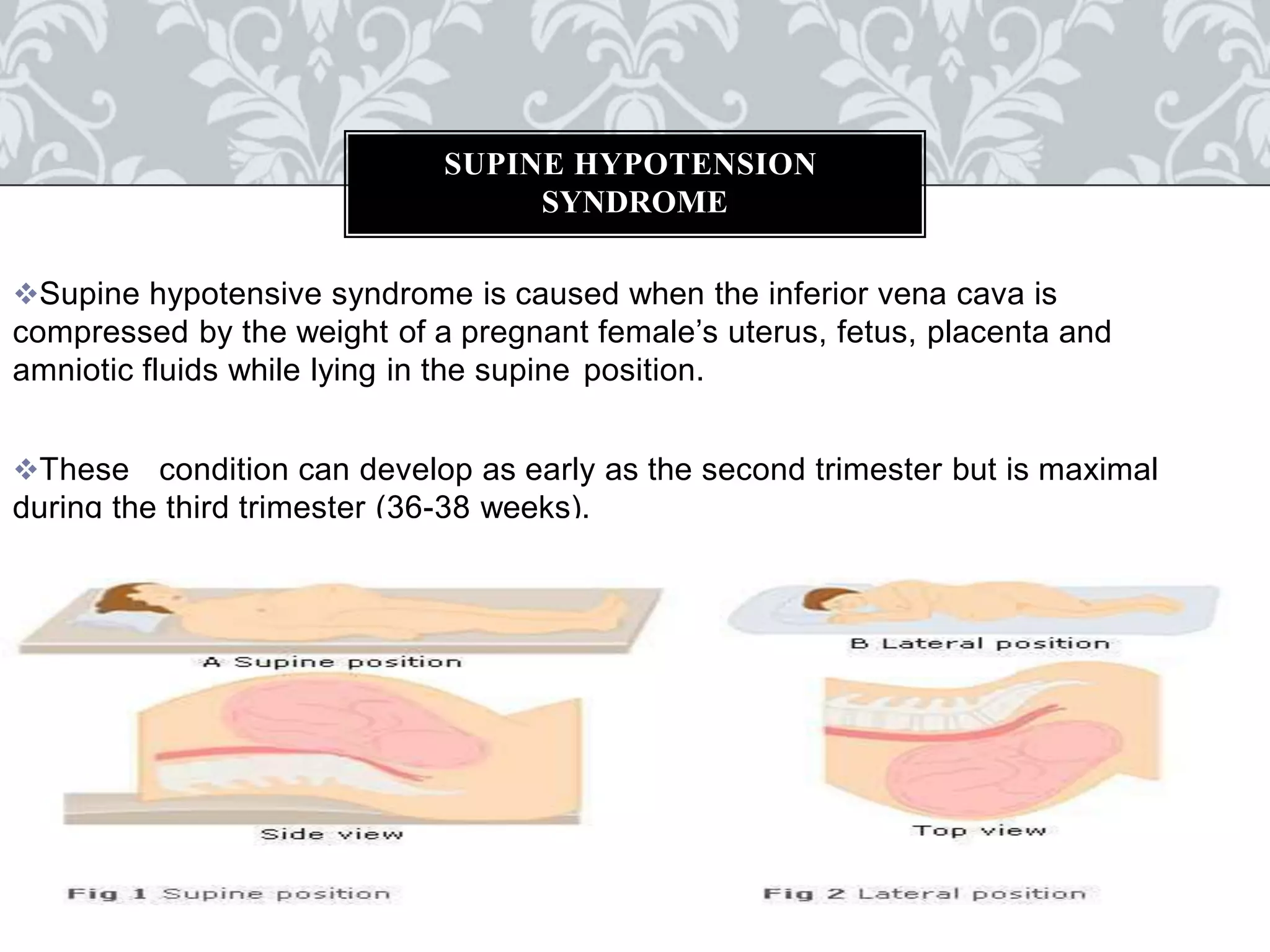 MINOR AILMENT DURING PREGNANCY | PPTX