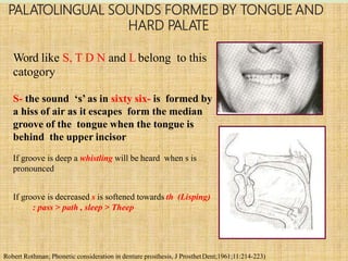 Phonitics In Complete Denture (with animations) | PPTX