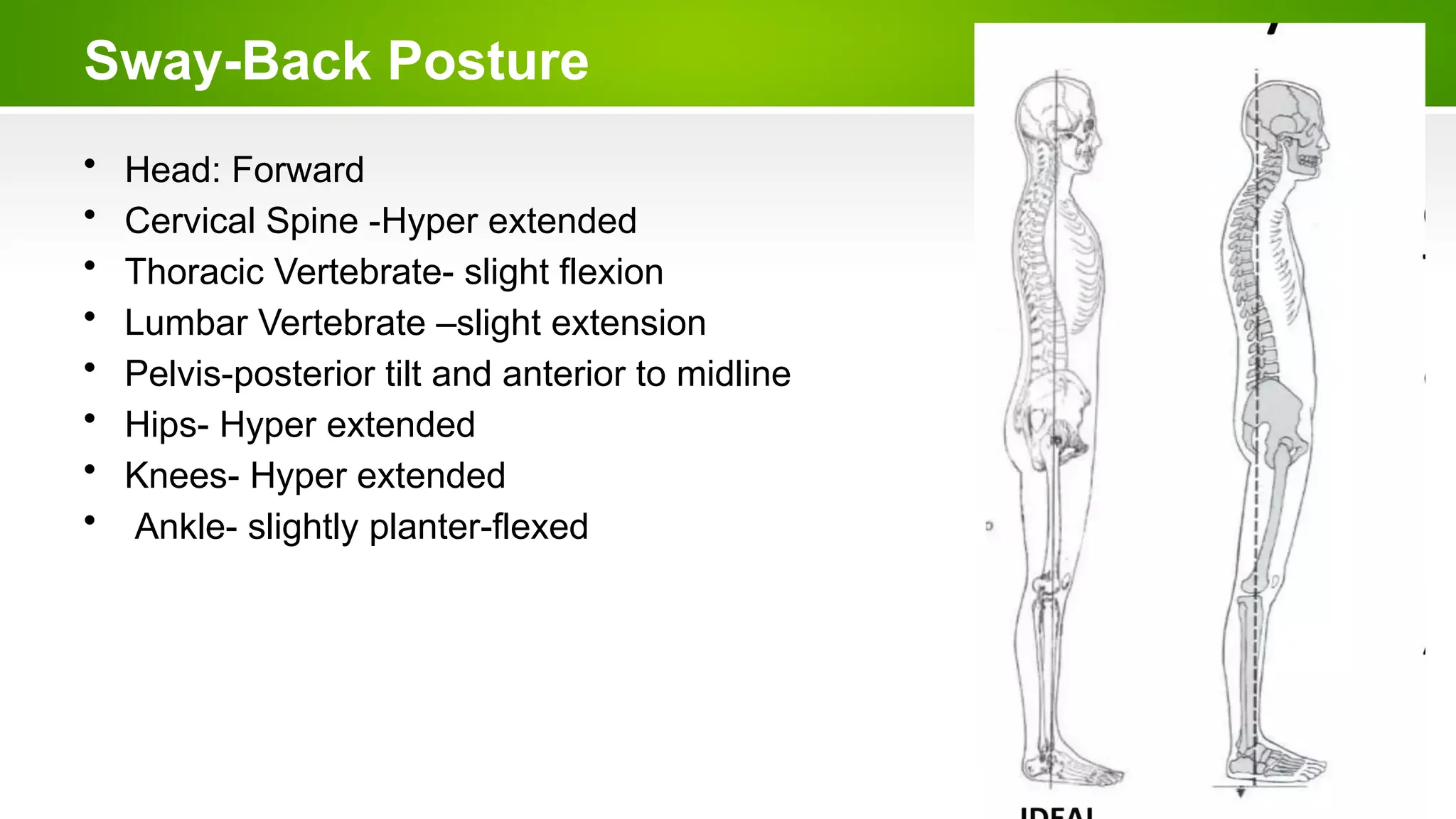 Sway-Back Posture
• Head: Forward
• Cervical Spine -Hyper extended
• Thoracic Vertebrate- slight flexion
• Lumbar Vertebrate –slight extension
• Pelvis-posterior tilt and anterior to midline
• Hips- Hyper extended
• Knees- Hyper extended
• Ankle- slightly planter-flexed
 