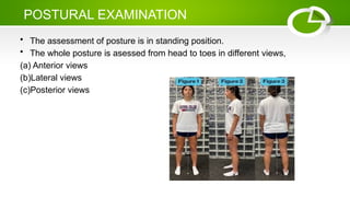 POSTURAL EXAMINATION
• The assessment of posture is in standing position.
• The whole posture is asessed from head to toes in different views,
(a) Anterior views
(b)Lateral views
(c)Posterior views
 