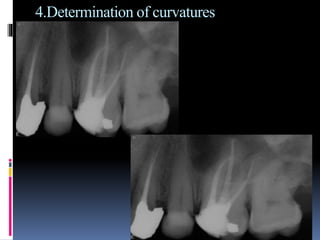 4.Determination of curvatures
 