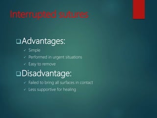 Interrupted sutures
Advantages:
 Simple
 Performed in urgent situations
 Easy to remove
Disadvantage:
 Failed to bring all surfaces in contact
 Less supportive for healing
 
