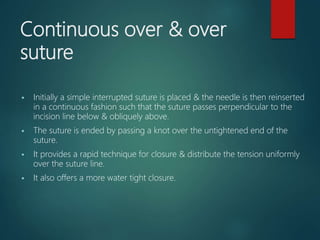 Continuous over & over
suture
 Initially a simple interrupted suture is placed & the needle is then reinserted
in a continuous fashion such that the suture passes perpendicular to the
incision line below & obliquely above.
 The suture is ended by passing a knot over the untightened end of the
suture.
 It provides a rapid technique for closure & distribute the tension uniformly
over the suture line.
 It also offers a more water tight closure.
 