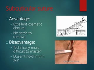 Subcuticular suture
 Advantage:
 Excellent cosmetic
closure.
 No stitch to
remove.
 Disadvantage:
 Technically more
difficult to master.
 Dosen’t hold in thin
skin
 