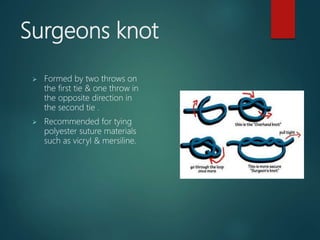 Surgeons knot
 Formed by two throws on
the first tie & one throw in
the opposite direction in
the second tie .
 Recommended for tying
polyester suture materials
such as vicryl & mersiline.
 