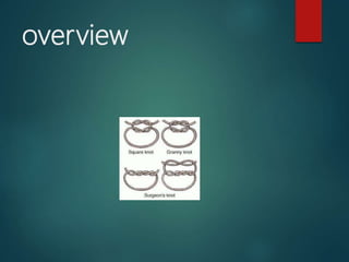 overview
 