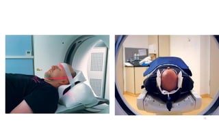 Orbit 75 Presentation on Radiological Anatomy of the Orbit | PPTX