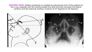 Presentation on Radiological Anatomy of the Orbit | PPTX