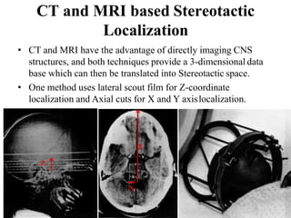 functional brain surgery DR ranjeet Bihari RIMS RANCHI | PPTX