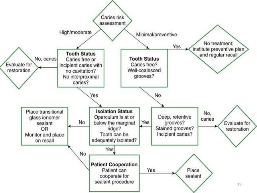 fissure sealant Presentation