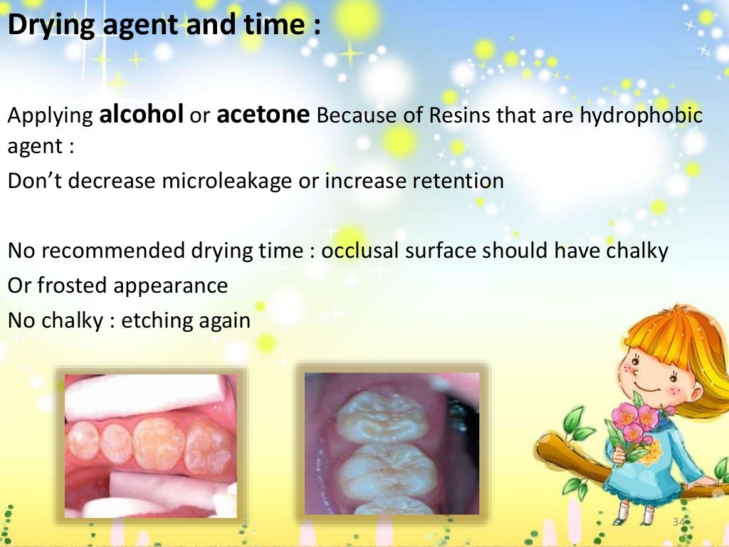 fissure sealant Presentation