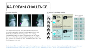Rj Radiographic PRECISION MEDICINE IN RA- newer advances | PPTX
