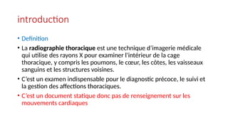 Presentation RADIO 2.pptxxxxxxxxxxxxxxxxxxxxxxxxxxxxxxxxx | PPTX