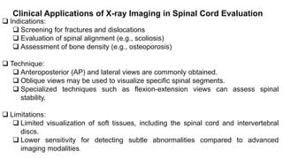 Inspect Spinal Alignment approach to radiology of spinal cord.pptx